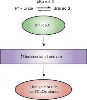 Formation Mechanisms and Characteristics of Uric Acid Stones