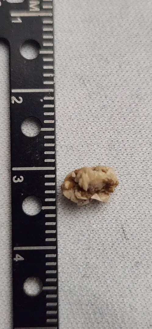 Update on that monster rock...