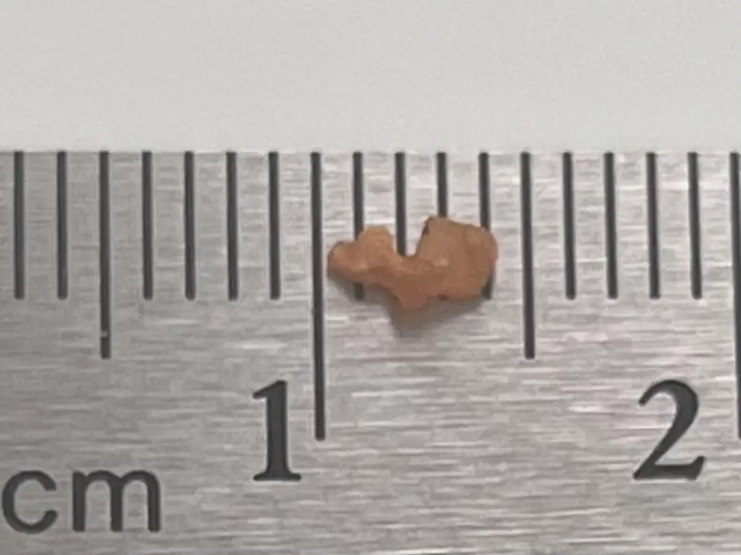 What size/type is my stone? — photo 1