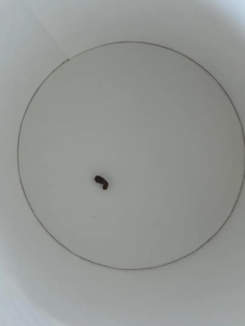 3 mm by 1mm kidney stone — photo 1