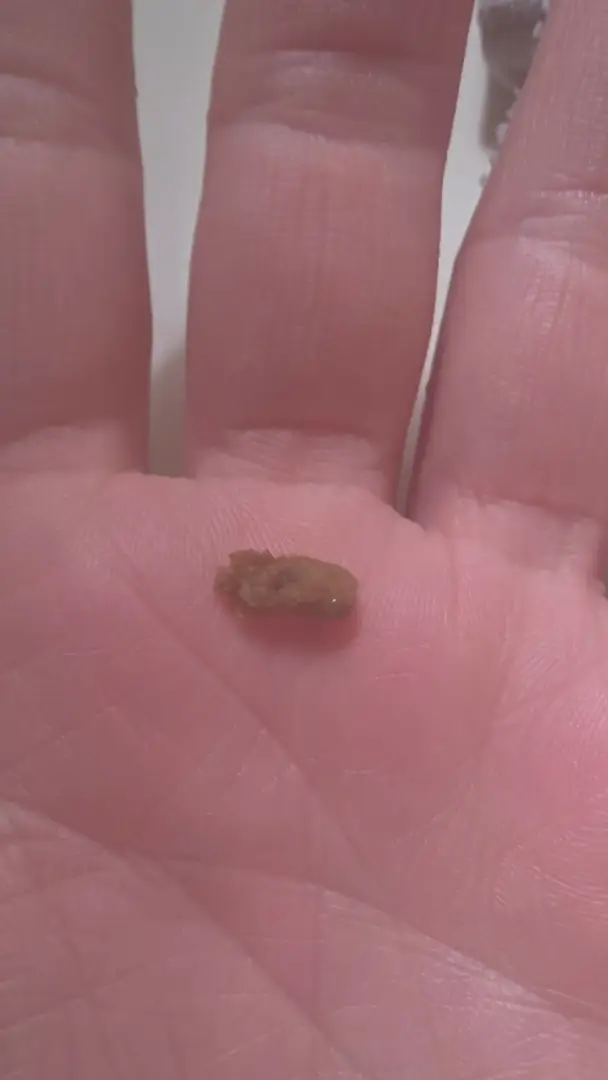 11mm passed this morning. — photo 6