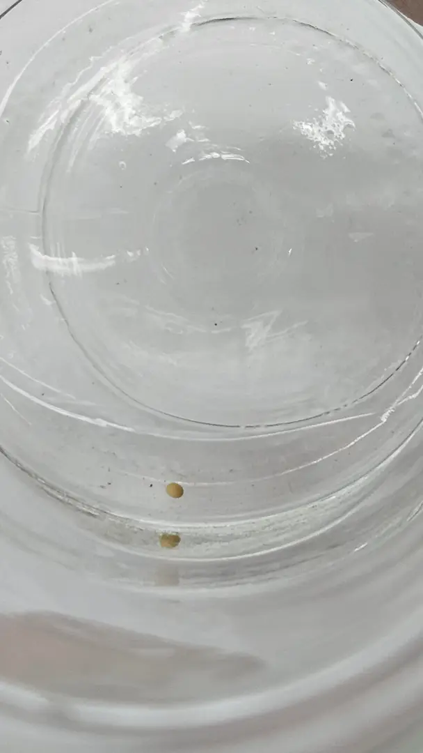Kidney stone won't dissolve — photo 2