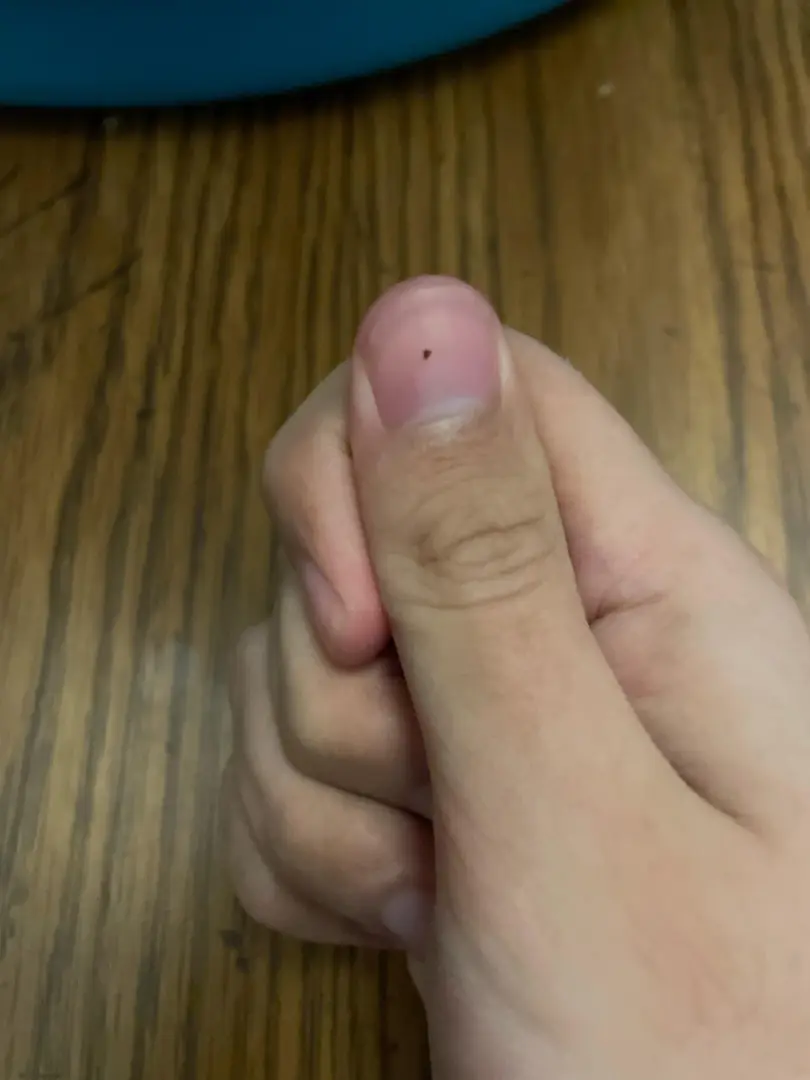 Can Stones Be This Tiny? β photo 1
