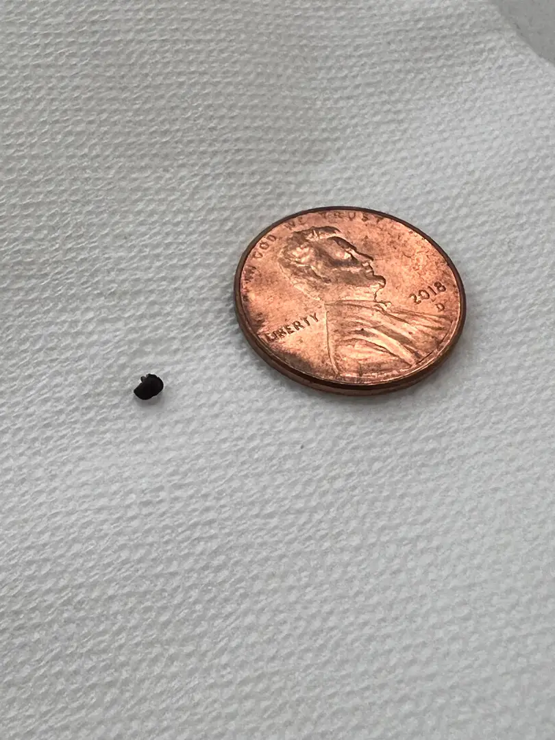 Woke up from a nap to 7/10 pain, went up to 10/10 that lasted 2 hours. So relieved it’s out of my body — photo 1