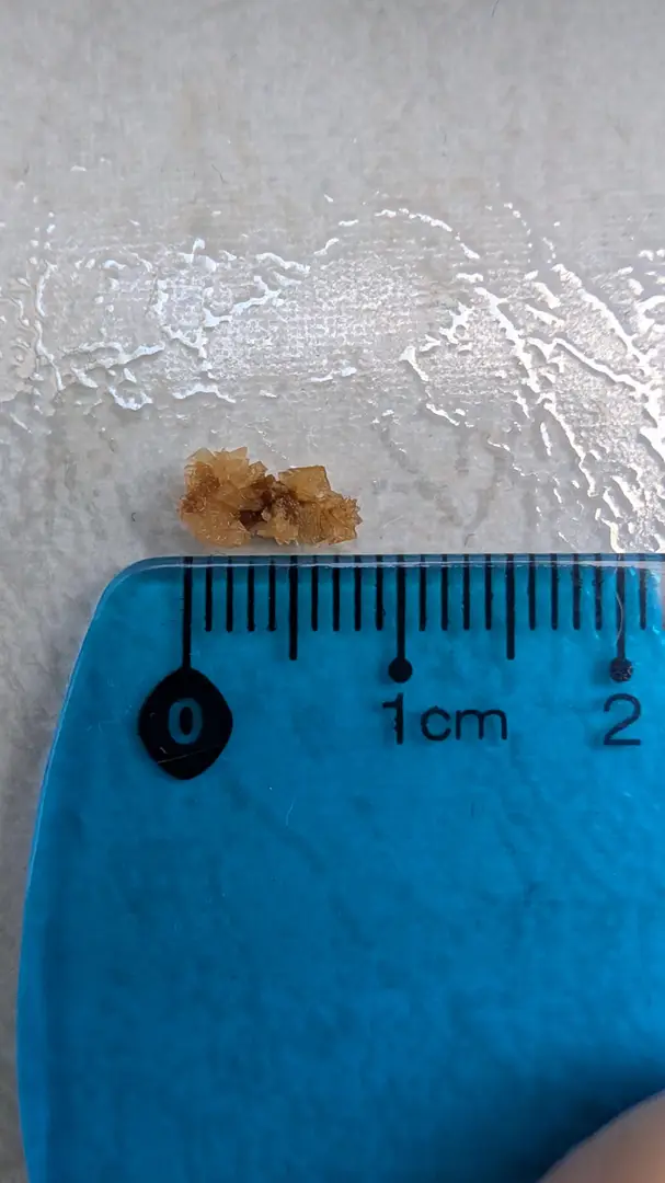 What a '4mm' stone looks like — photo 2