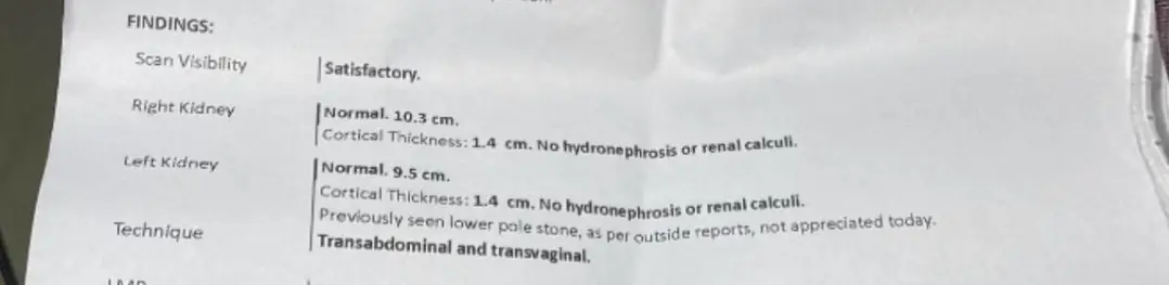 Can a 5 mm lower pole kidney stone go away without me knowing? — photo 2