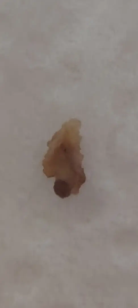 Did I just pass a stone? — photo 1
