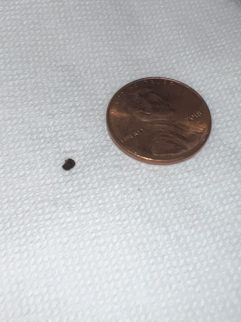 Woke up from a nap to 7/10 pain, went up to 10/10 that lasted 2 hours. So relieved it’s out of my body — photo 3