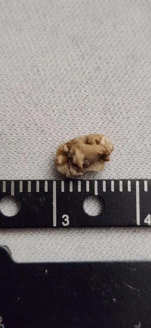 Update on that monster rock... โ photo 2