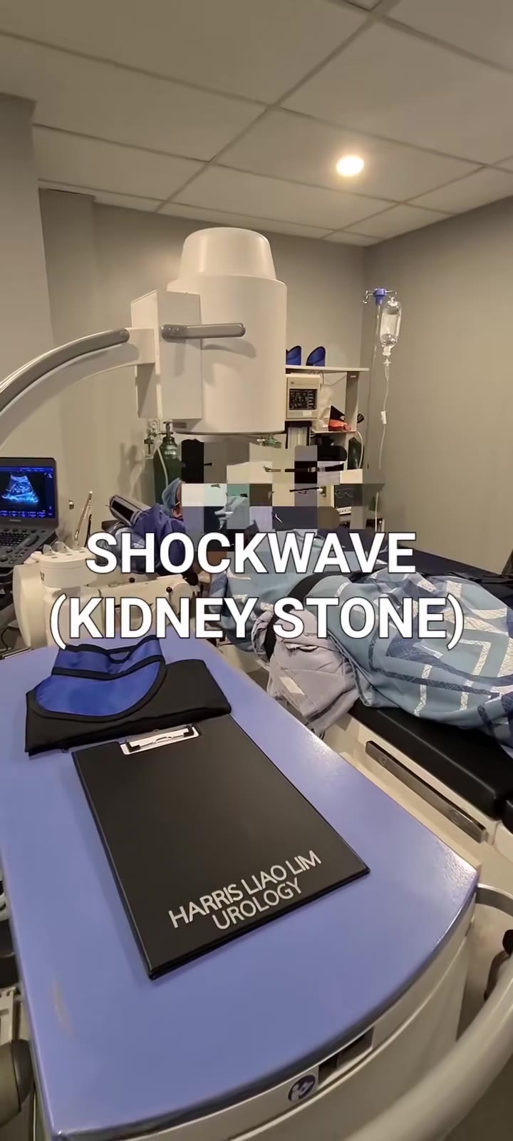 Extracorporeal Shock Wave Lithotripsy ESWL 40 year old fema