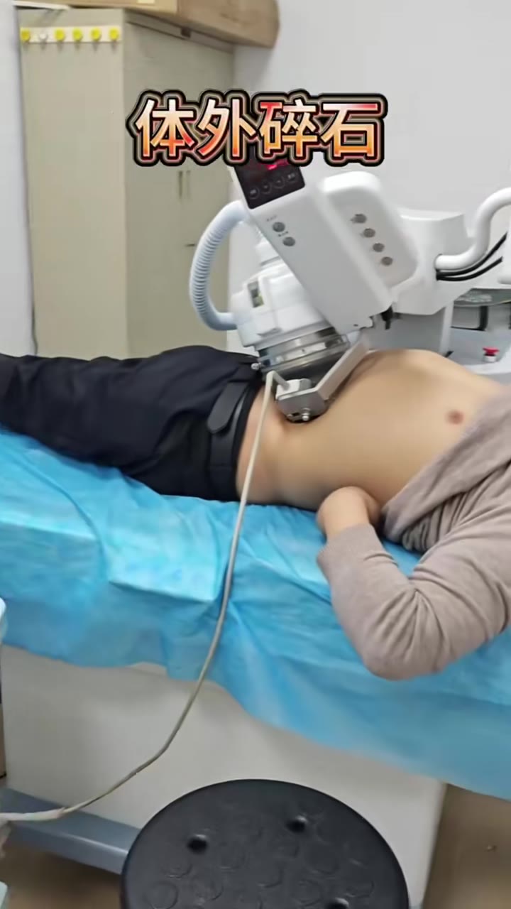 Kidney Stone Treatment Without Surgery Shockwave Therapy