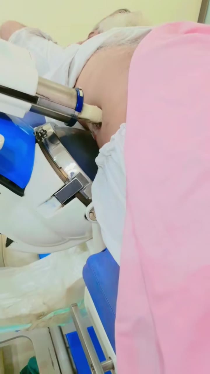 creatorsearchinsights kidney stone Treatment ESWL